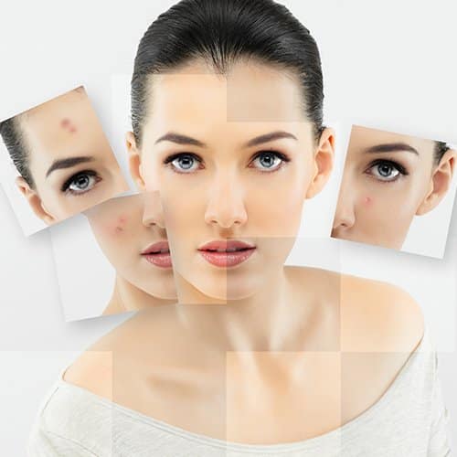 Peeling professionnel du visage