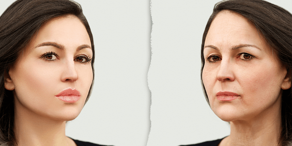 Skin aging with loss of collagen Beauty Blog